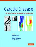 Carotid Disease