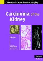 Carcinoma of the Kidney