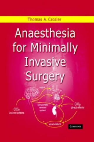 Anaesthesia for Minimally Invasive Surgery