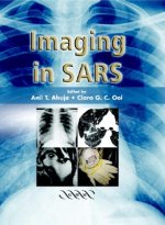 Imaging in SARS