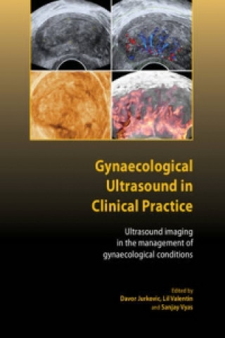 Gynaecological Ultrasound in Clinical Practice