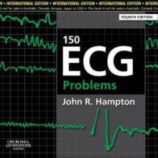 150 ECG Problems, International Edition