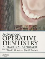 Advanced Operative Dentistry