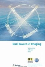 Dual Source CT Imaging