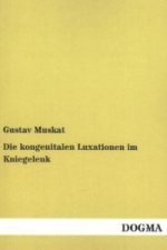 Die kongenitalen Luxationen im Kniegelenk