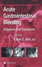 Acute Gastrointestinal Bleeding