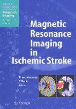 Magnetic Resonance Imaging in Ischemic Stroke