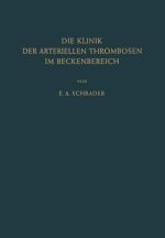 Klinik Der Arteriellen Thrombosen Im Beckenbereich