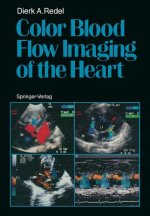 Color Blood Flow Imaging of the Heart
