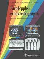 Atlas Der Farbdopplerechokardiographie