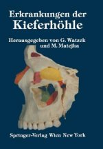Erkrankungen Der Kieferh hle