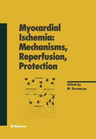 Myocardial Ischemia: Mechanisms, Reperfusion, Protection