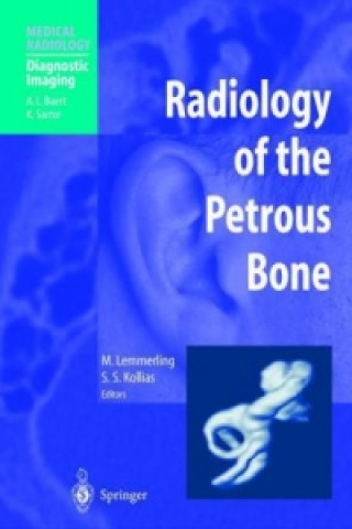 Radiology of the Petrous Bone