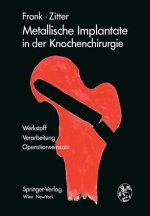 Metallische Implantate in Der Knochenchirurgie