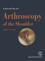 Arthroscopy of the Shoulder