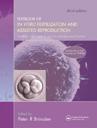 Textbook of In Vitro Fertilization and Assisted Reproduction