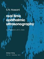 real time opthalmic ultrasonography