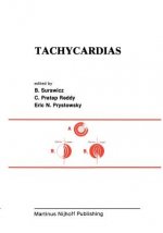 Tachycardias