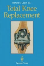 Total Knee Replacement