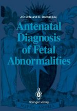 Antenatal Diagnosis of Fetal Abnormalities