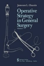 Operative Strategy in General Surgery