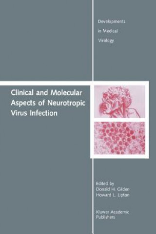 Clinical and Molecular Aspects of Neurotropic Virus Infection