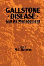 Gallstone Disease and its Management