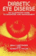 Diabetic Eye Disease