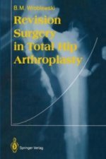 Revision Surgery in Total Hip Arthroplasty