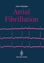 Atrial Fibrillation