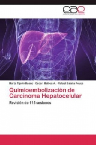 Quimioembolizacion de Carcinoma Hepatocelular
