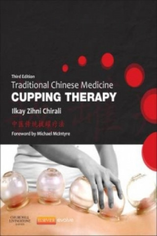 Traditional Chinese Medicine Cupping Therapy