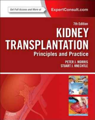 Kidney Transplantation - Principles and Practice