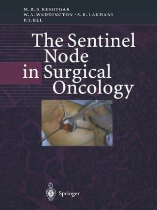 Sentinel Node in Surgical Oncology