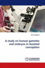 A study on human gametes and embryos in Assisted conception