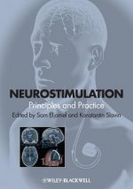 Neurostimulation - Principles and Practice