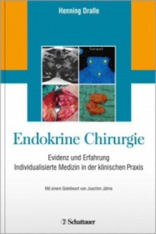Endokrine Chirurgie