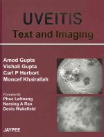 UVEITIS Text and Imaging