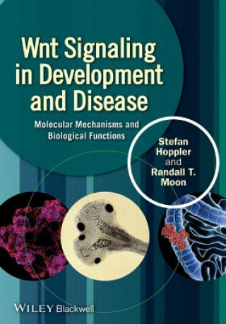 Wnt Signaling in Development and Disease - Molecular Mechanisms and Biological Functions