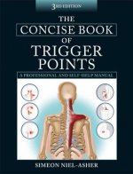 Concise Book of Trigger Points