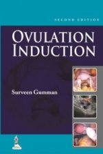 Ovulation Induction