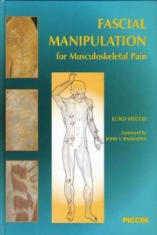 Fascial Manipulation for Muscoskeletal Pain