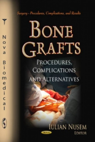 Bone Grafts