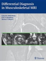 Differential Diagnosis in Musculoskeletal MR