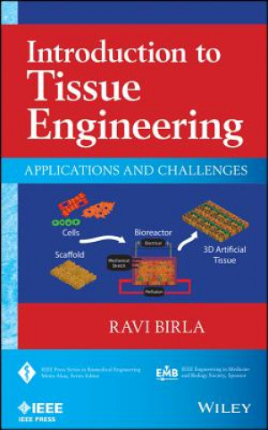 Introduction to Tissue Engineering - Applications and Challenges