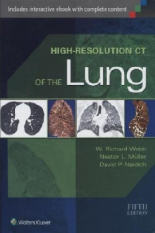High-Resolution CT of the Lung