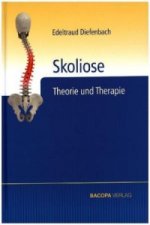 Skoliose