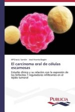carcinoma oral de celulas escamosas
