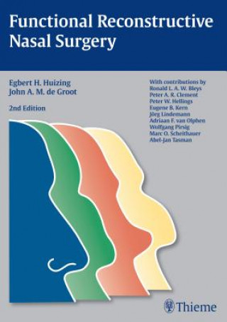 Functional Reconstructive Nasal Surgery (Egbert H. Huizing,John A. M. de Groot,Egbert H. Huizing)()