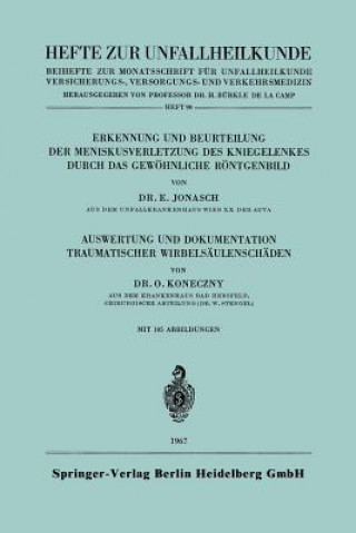 Erkennung Und Beurteilung Der Meniskusverletzung Des Kniegelenkes Durch Das Gewoehnliche Roentgenbild. Auswertung Und Dokumentation Traumatischer Wirb